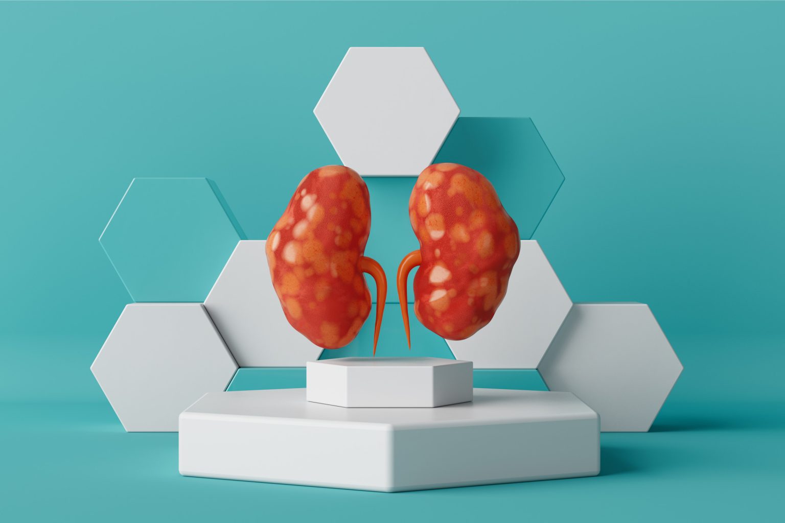 Νεφρά: Ποιες τροφές μπορούν να προκαλέσουν νεφρική βλάβη; Πώς να προστατευτείτε;