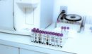 Λαμία: Εντοπίστηκε σαλμονέλα και σε άλλες παρτίδες κοτόπουλου - Τι δείχνουν οι νέοι έλεγχοι
