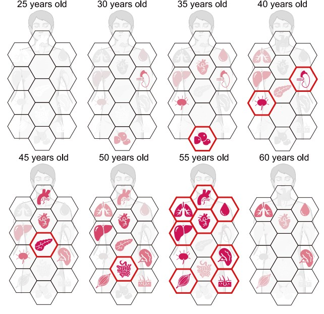 Τα όργανα του σώματος σύμφωνα με τις ηλικίες στις οποίες είναι πιο ευαίσθητα στη γήρανση. Φωτογραφία: Ding et al., Cell, 2025