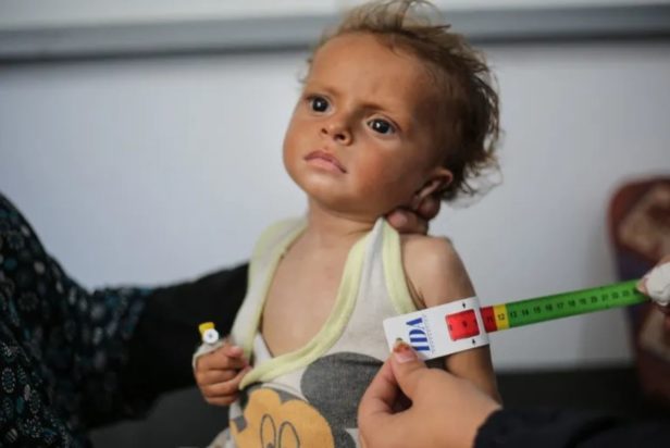 Γάζα πείνα λιμός