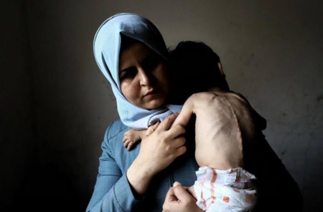 Γάζα πείνα λιμός