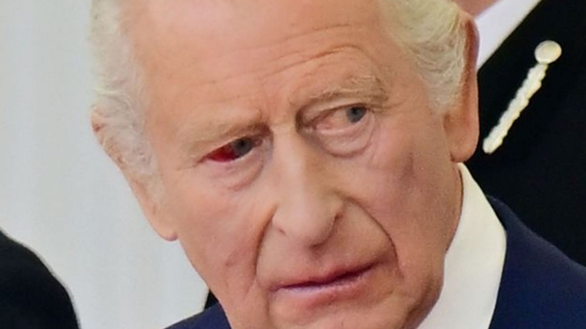 Βασιλιάς Κάρολος: Ανησυχία για το κόκκινο μάτι του στην υποδοχή Μακρόν – Τι απαντά το Παλάτι