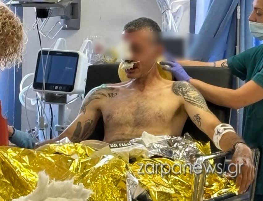 Χανιά: Σοβαρός τραυματισμός πρωταθλητή ποδηλασίας – Έπεσε σε λακκούβα – ΦΩΤΟ 