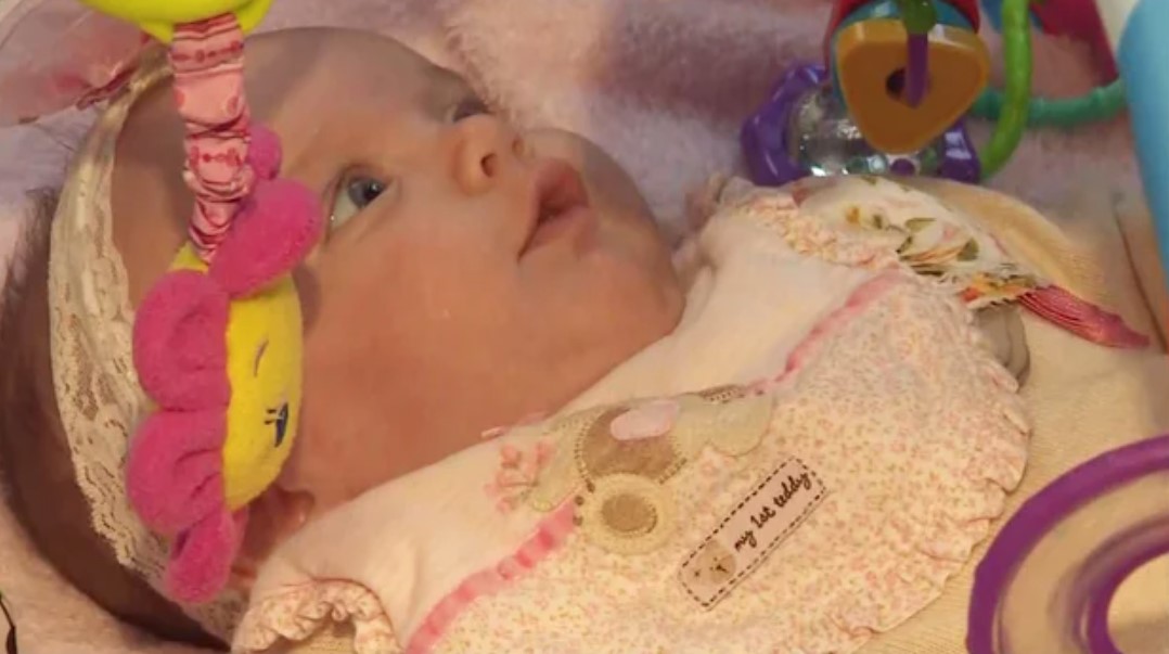 Ιατρικό θαύμα: Πώς ένα μωρό «γεννήθηκε δύο φορές» για να σωθεί η ζωή του