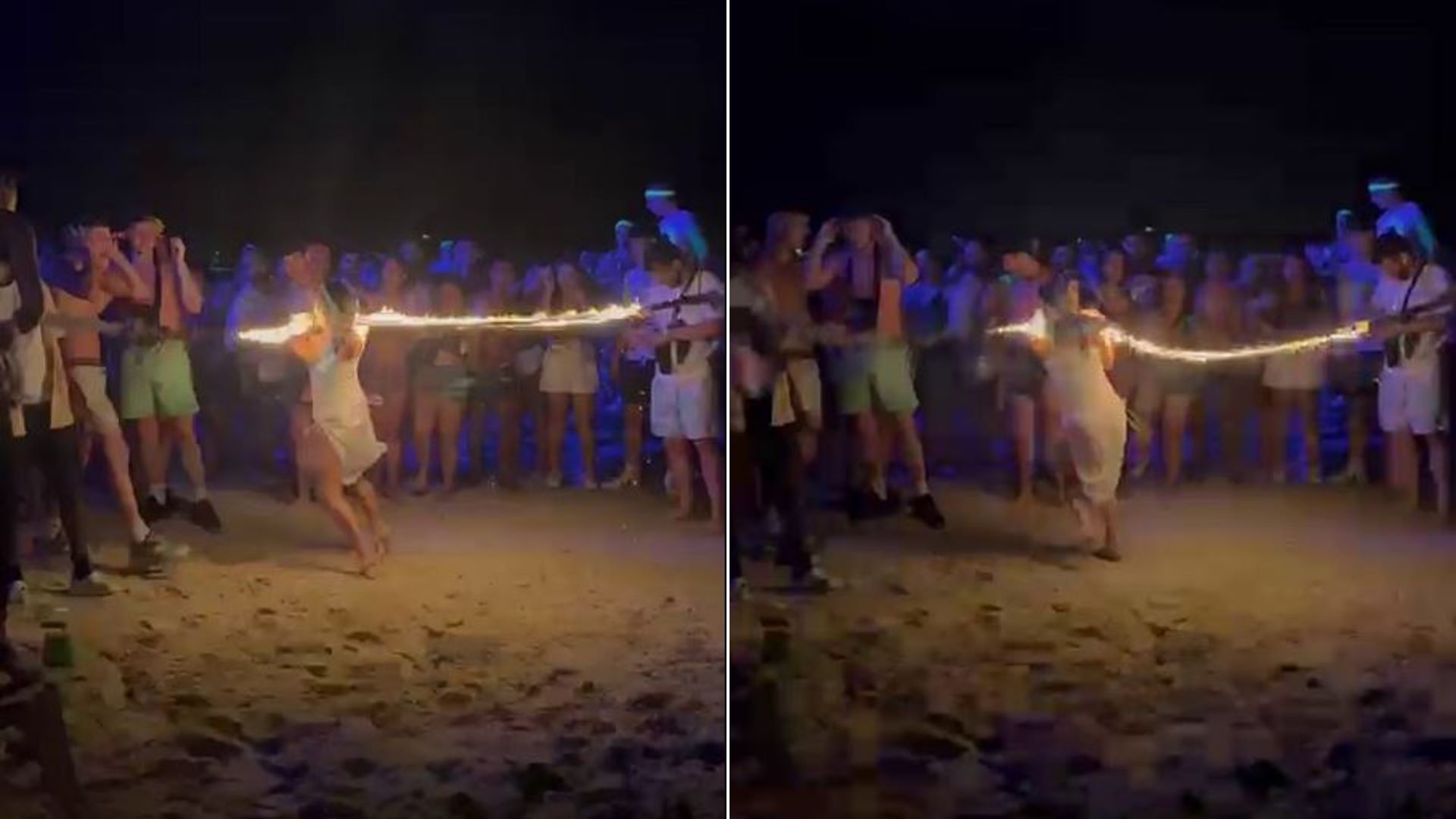 Βίντεο: Φλεγόμενο σχοινί «έψησε» τον λαιμό 22χρονης σε beach party – «Πονούσε και άρχισα να κλαίω»