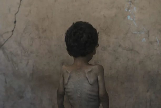 ΓΑΖΑ ΠΑΙΔΙΑ ΥΠΟΣΙΤΙΣΜΕΝΑ