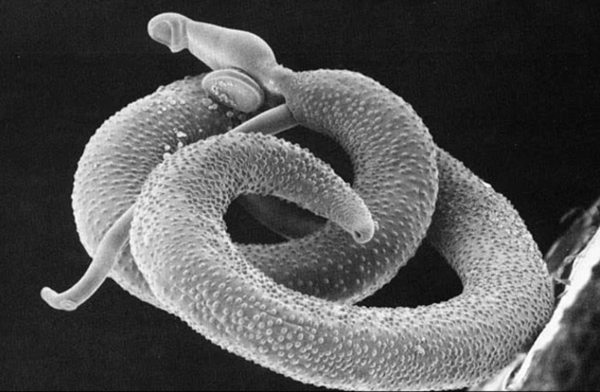 Επιστήμονες ανακάλυψαν παράσιτο που διεισδύει στο ανθρώπινο σώμα χωρίς να γίνει αντιληπτό – Μπορεί να προκαλέσει καρκίνο