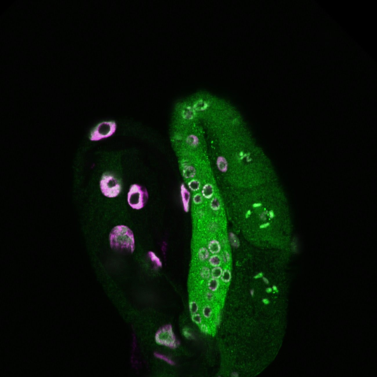 Η εικόνα με σχήμα τουλίπας ενός σκώληκα δείχνει το έντερο στα αριστερά και τη γενετική γραμμή στα δεξιά. Το πράσινο χρώμα επισημαίνει τη διμεθυλίωση της ιστόνης H3 λυσίνης 79, ενώ το ροζ επισημαίνει τους κυτταρικούς πυρήνες που έχουν βαφτεί με DAPI. Φωτογραφία: Meng Wang
