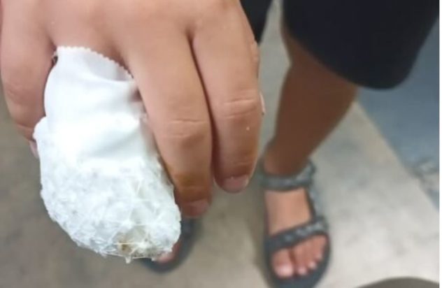 Δράμα: Τραυματισμός 8χρονου σε παιδική χαρά