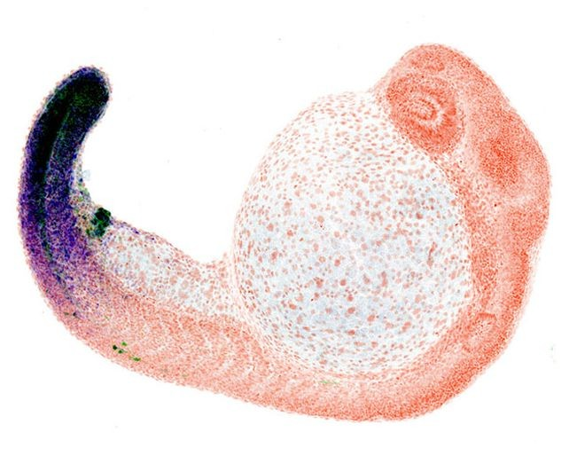 Έμβρυο από ψάρι – ζέβρα με ενεργοποιημένη την περιοχή της κλοάκης. Φωτογραφία: Brent Hawkins/UNIGE