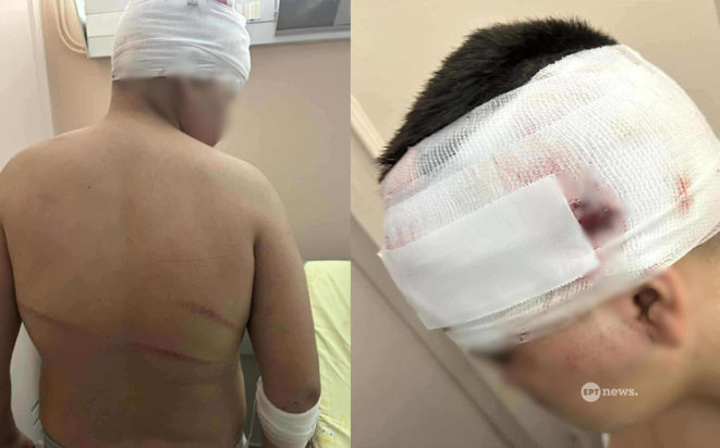 επίθεση Συκιές