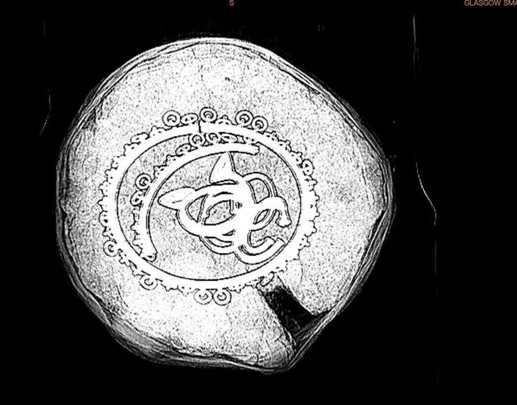 Φωτογραφία: GUARD Archaeology Ltd The Penannular Bar Bracelets.