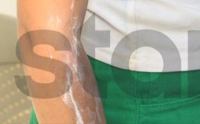 Σεπόλια, κοριτσάκι, απόπειρα απαγωγής