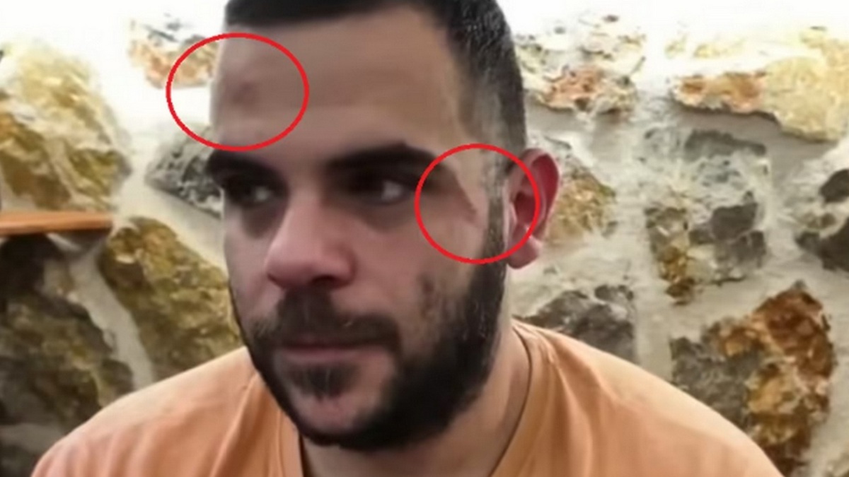 Ο Youtuber Teosty δέχτηκε επίθεση την ώρα που έκανε live μετάδοση – Τον χτύπησαν σε σώμα και πρόσωπο