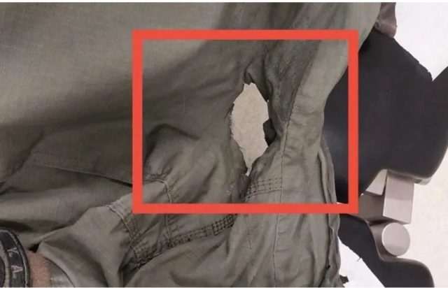 Η στολή του τραυματία αστυνομικού στο ΑΠΘ