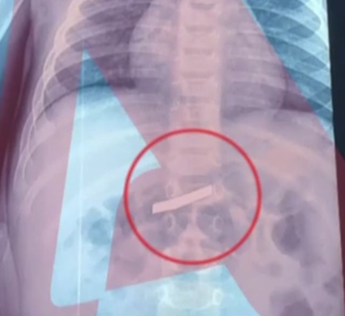 ΞΥΡΑΦΙ ΠΑΙΔΑΚΙ