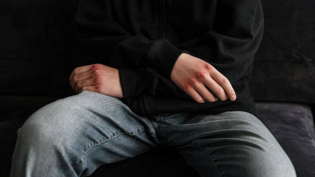 Ηράκλειο: 14χρονος χτύπησε συμμαθητή και έσπασε τα γυαλιά του