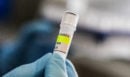 ΗΠΑ: Υπό ιατρική παρακολούθηση από τα CDC 41 άτομα τις επόμενες εβδομάδες, για επαφές με κρούσματα χανταϊού