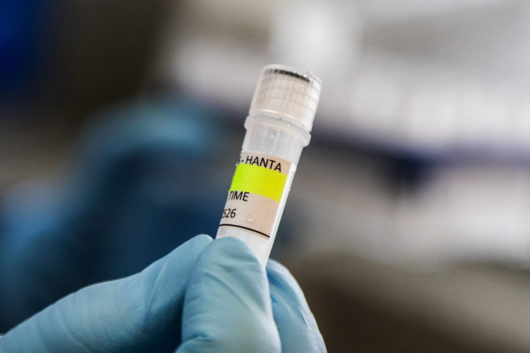 HANTAVIRUS