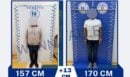 Επιμήκυνση άκρων στην Τουρκία με... 23.000 ευρώ: Τους «σπάνε» τα πόδια με σκοπό να γίνουν ψηλότεροι