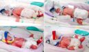 Αυστραλία: Γεννήθηκαν πανομοιότυπα τετράδυμα από φυσική σύλληψη - «Οι καρδιές μας είναι γεμάτες ευγνωμοσύνη» λένε οι γονείς