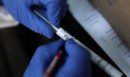 Medwatch: Μπότοξ και υαλουρονικό σε οδοντιατρεία, επιχειρήσεις χωρίς βεβαίωση λειτουργίας - Τι κατέγραψε το πρώτο 10ήμερο