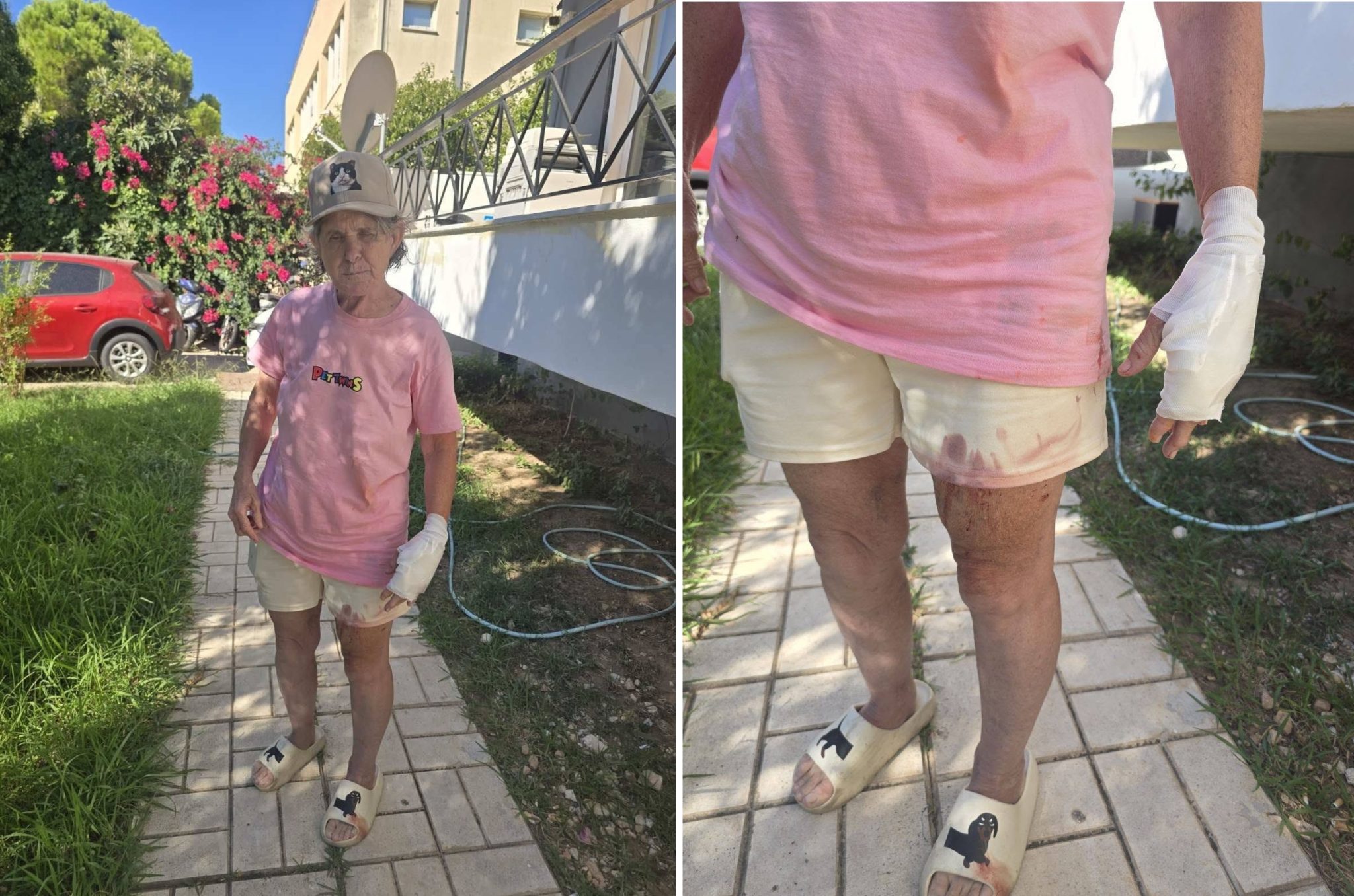 Βάρη, Επίθεση σκύλων